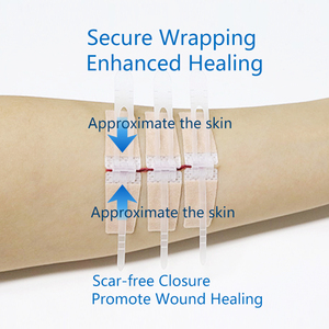 Tùy chỉnh bệnh viện lớp vết thương chăm sóc Zip khâu khâu y tế hàng tiêu dùng cho phòng khám - Product Image 5