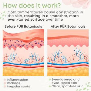 Es acial, ryoterapia, certificación CE, ellulite para ACE & Ye uffiness igigraine Ain elief y eliinor Jury njury - Product Image 4