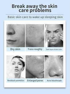 Appareil professionnel de nettoyage des pores chaud et froid, élimination des points noirs, resserrement des pores, éclaircissement de la peau - Product Image 2