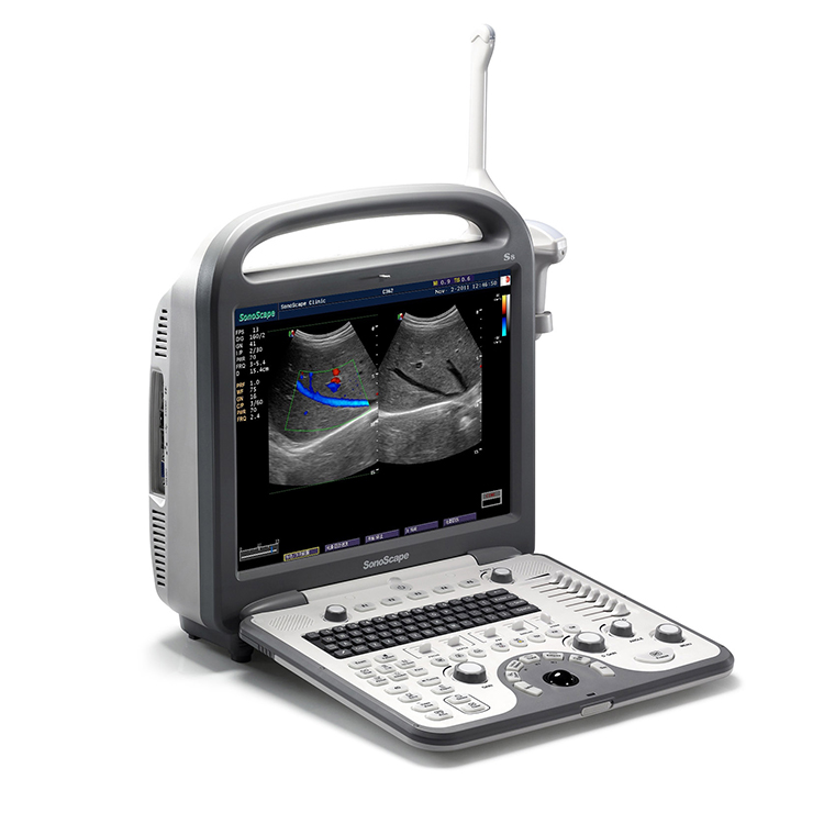 Ecografía ecógrafo 4D portátil Sonoscape S8 B/ 2B/ 4B/ M/CW Doppler Color