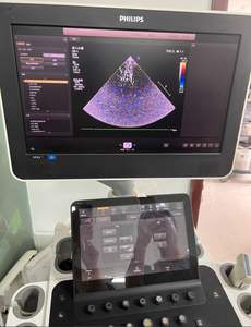 Fourniture et réparation de la machine à ultrasons EPIQ 5 ,EPIQ 7 Dépannage des problèmes d'imagerie - Product Image 6