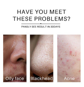 OEM ODM, leche pura, blanqueamiento, lavado de cara, refinar los poros ilumina la tez, <span class=keywords><strong>limpiador</strong></span> <span class=keywords><strong>facial</strong></span> para cara aceitosa - Product Image 3