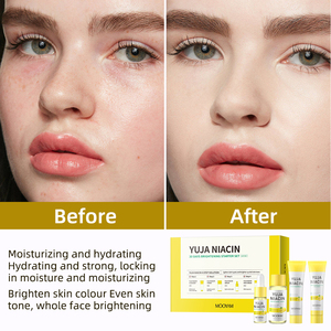 Set de Cuidado Facial Iluminador de Yuja y Niacinamida de <span class=keywords><strong>30</strong></span> Días, Incluye Limpiador Facial, Tónico, Sérum y Crema Facial, Set de Cuidado Facial MOOYAM - Product Image 5