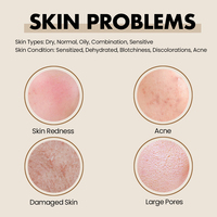 Produits de soin de la peau Vegan Redness Solutions, crème hydratante réparatrice en profondeur pour le visage, à l'aloe vera, pour les peaux sensibles et abîmées