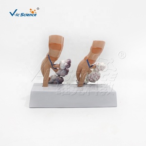 Modelo <span class=keywords><strong>de</strong></span> Comparación <span class=keywords><strong>de</strong></span> Pulmones: Pulmón Saludable vs. Pulmón <span class=keywords><strong>de</strong></span> <span class=keywords><strong>Fumador</strong></span> con Base, Herramienta Educativa para el Control del Tabaco - Product Image 6