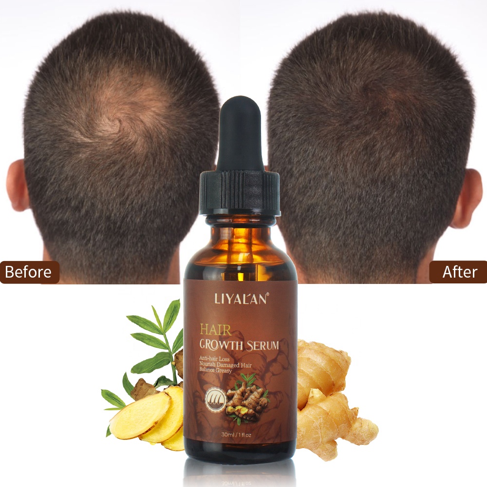 Фирменная Имбирная восстанавливающая питательная сыворотка для волос от выпадения и роста кожи головы