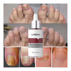 Suero Reparador de Uñas Antihongos LANBENA, Líquido Fortalecedor para Uñas Dañadas, Cuidado de los Pies, 0.5 Fl oz - Product Image 3