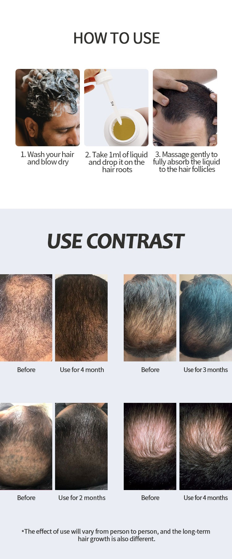 Hbf8fc12fe1e5461d957c5cd671ebaca99 6PCS Best Selling Hit Brand best Men's Liquid Solution Topical Treatment for Thinning Hair Growth spray serum peptides