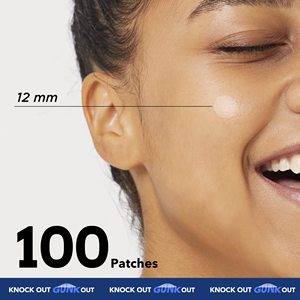 Apósitos autoadhesivos de alta absorción para úlceras por presión, cuidado del acné, rollo de hidrocoloide estéril e impermeable para el cuidado de heridas, certificado CE YOJO - Product Image 4