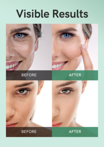 Bingo Skin Care <strong>Manufacturer</strong> Brighten Dark Spot Improve Rough Face Sheet Mask Organic Lemon Extract Niacinamide Face Mask - Product Image 6