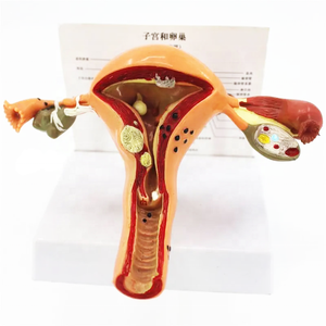 Modelo de útero patológico para mujer, modelo médico femenino para demostración - Product Image 1
