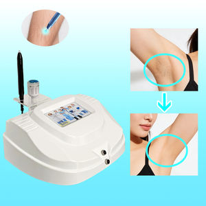 Electrolisis para el Crecimiento del Vello Corporal, como el síndrome de ovario poliquístico (SOP). Solución para el vello no deseado. Resultados Graduales y Permanentes. - Product Image 1