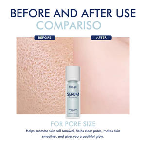 Hoygi เซรั่มสำหรับรูขุมขนขนาดรูขุมขนและลดจุดด่างดำรูขุมขนที่ละเอียดอ่อนและเรียบเนียนผิวขาว - Product Image 6