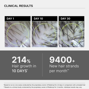 オウムオーガニックハーバルジンジャーエッセンシャルオイルオイル頭皮血清栄養ビオチン育毛製品トリートメント育毛血清 - Product Image 3