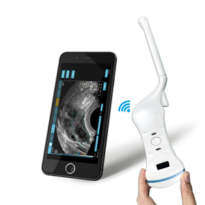 Sonda de Ultrasonido Transvaginal Inalámbrica de Doble Cabezal con Escáner de Ultrasonido Doppler a Color Portátil para Ginecología y Obstetricia con Garantía de 1 Año - Product Image 1
