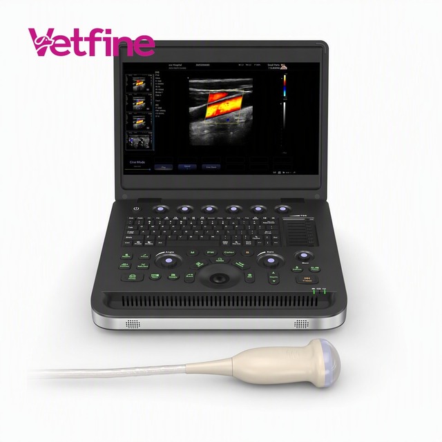 Medical Portable Laptop Type Color Doppler Ultrasound Machine With 3D 4D Imaging Function Full Digital HD Display