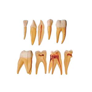 HC-S401 modèle de dent Standard pratique fausses dents dentaires modèle de dent géante support modèle d'agrandissement des dents - Product Image 3