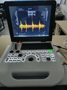 3d 4d Máquina Mais Barato Venda Quente Portátil Cor <span class=keywords><strong>Doppler</strong></span> Ultrassom Máquina Humano Vet - Product Image 4