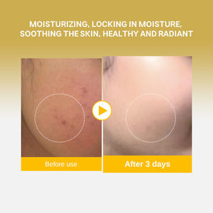 Spray de Suero Vegano con Trufa Blanca Italiana Personalizado OEM, Bruma Facial Hidratante para una Piel Radiante, Bruma Iluminadora Todo en Uno <span class=keywords><strong>No</strong></span> Comedogénica - Product Image 5