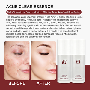 เซรั่มสำหรับสิวสูตรอ่อนโยนพร้อมกรดซาลิไซลิกและสังกะสีช่วยบรรเทาผิวอักเสบและรอยแผลเป็นจากโรงงาน - Product Image 3