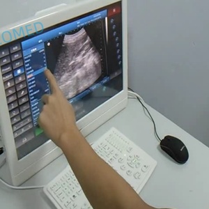 Échographe à écran tactile haute performance, écran LED 18,5 pouces, design élégant, appareil d'échographie noir et blanc vétérinaire BW08 - Product Image 3