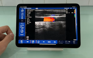 Sonde sans fil DMU97, 192 éléments, 64 canaux, sonde d'échographie linéaire, scanner d'échographie Doppler couleur - Product Image 3