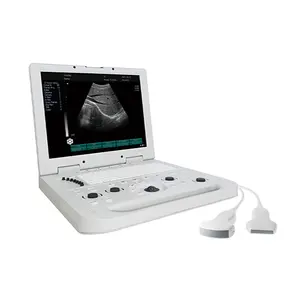 Máquina de ultrasonido B/W digital portátil de alta calidad para clínica