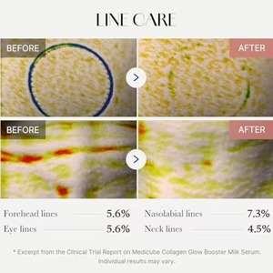 Suero Facial Coreano Medicube Personalizado al por Mayor, con Niacinamida, Extracto de Proteína de Leche, Colágeno Hidrolizado, para una Piel Radiante e Hidratada - Product Image 5