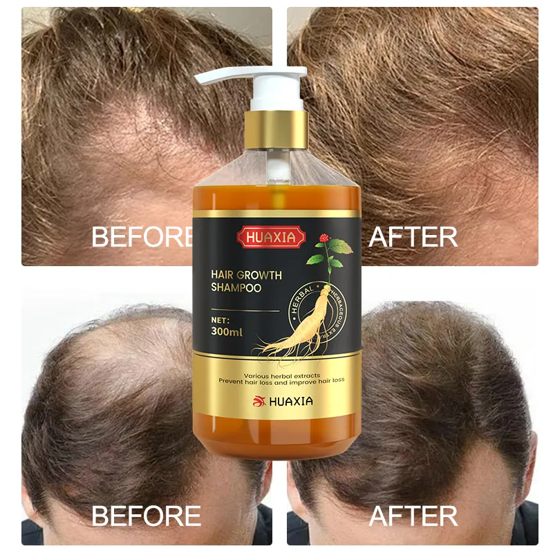 HuaXia Herbal Oil Control Extractos naturales Vigorizan el cabello Tea Tree Oil Champú para el crecimiento del cabello Champú vegano