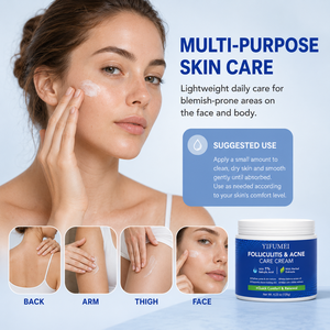 ครีมลดสิวผสมกรดซาลิไซลิก 1% และกรดไฮยาลูรอนิก สำหรับผิวหน้า/ผิวกาย ช่วยให้ผิวขาว ลดรอยแผลเป็น กระชับรูขุมขน ควบคุมความมัน (Private Label) - Product Image 3
