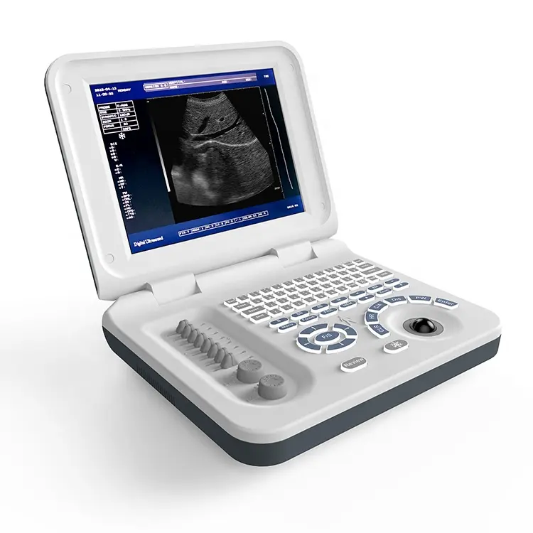Scanner a ultrasuoni portatile con schermo a LED scanner a ultrasuoni portatile con diverse sonde