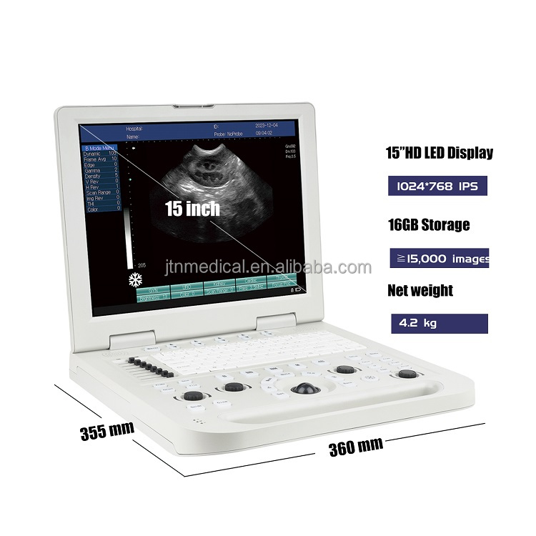 Factory Veterinary Portable Livestock Ultrasound Machine