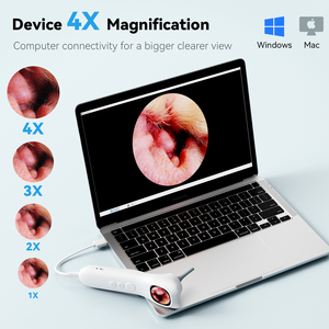 Tai máy ảnh với 1080P HD Màn hình 3.2 mét đường kính và 1.28inch loại bỏ ráy tai otoscope - Product Image 3