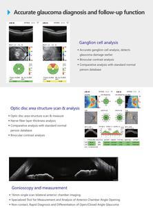Equipo de Diagnóstico Oftalmológico con Función de Análisis de Campo Amplio, Angiografía, Tomografía de Coherencia Óptica HS-300 - Product Image 3