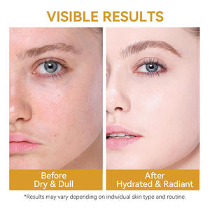 Suero Facial OEM para el Cuidado de la Piel, Antienvejecimiento, Reafirmante, Reduce Poros, Blanqueador, Hidratante, Nutritivo, Calmante, con Ácido Hialurónico y Arroz - Product Image 6