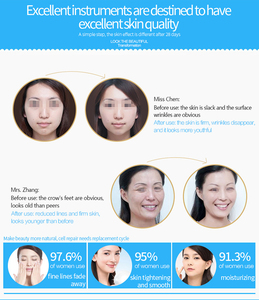 Máquina de Belleza Facial 2 en 1 con Martillo Frío y Caliente y Activador de Vibración de Energía Magnética Sonar - Product Image 2