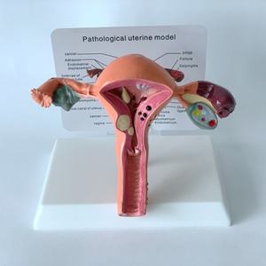 Modelo de Útero Femenino de Alta Calidad, Modelo de Útero Fantómico - Product Image 2