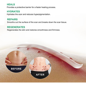 Crème pour le visage Aliver, crème pour éliminer les cicatrices, pour améliorer les cicatrices de brûlures, réduire la pigmentation, améliorer les cicatrices d'acné - Product Image 4