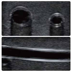 Modelo <span class=keywords><strong>de</strong></span> Entrenamiento para Acceso Venoso Central Guiado por Ultrasonido Scalptek IG017-S1, Cabeza, <span class=keywords><strong>Cuello</strong></span> y Hombros Completos, <span class=keywords><strong>Vasos</strong></span> IJV, Subclaviarios y Axilares - Product Image 4