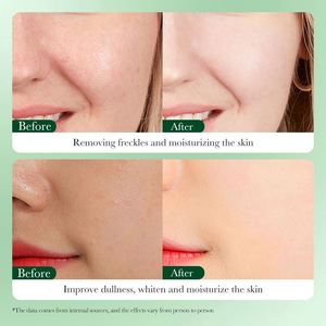 Nhãn Hiệu Riêng Cam Thảo VC Mặt Kem Dưỡng Ẩm Tự Nhiên Cho Người Lớn Làm Trắng Sáng Chất Chống Oxy Hóa Điện Khô Da Nếp Nhăn - Product Image 6