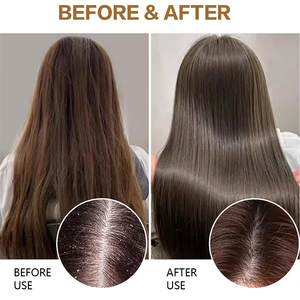 Fabricant OEM de produits capillaires hydratants et clarifiants en profondeur sans sulfate Shampooing protéiné à la kératine pour cheveux clairsemés - Product Image 5