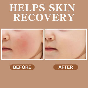 Crema a base di erbe per <span class=keywords><strong>Eczema</strong></span> bambino crema <span class=keywords><strong>Eczema</strong></span> idratante lozione per il corpo - Product Image 5