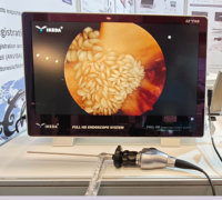 Système d'endoscopie médicale électrique FHD 1080P avec moniteur intégré de 22 pouces pour capteur CMOS pour arthroscopie, laparoscopie, chirurgie de l'oreille