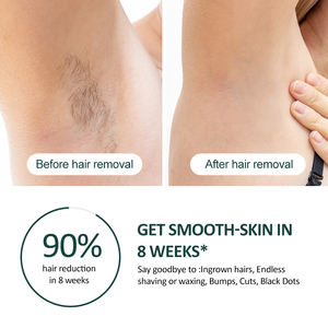 Depilación láser Ipl de zafiro de 5 niveles, 3 modos, casi indolora, refrigeración por hielo, depilación láser 15J, el <span class=keywords><strong>mejor</strong></span> dispositivo láser para el hogar - Product Image 4