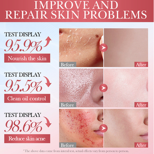 Nhãn hiệu riêng OEM Collagen mặt bóc mặt nạ sâu hydrat hóa loại bỏ mụn đầu đen chăm sóc da 80 gam mooyam gói Mặt nạ trên khuôn mặt - Product Image 4