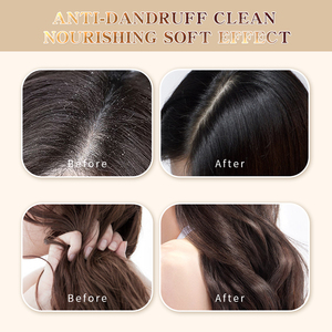 Vente en gros pas cher personnalisé romarin <span class=keywords><strong>bio</strong></span> soins capillaires shampooing huile d'argan ginseng shampooing et après-shampooing pour prévenir la perte de cheveux - Product Image 5