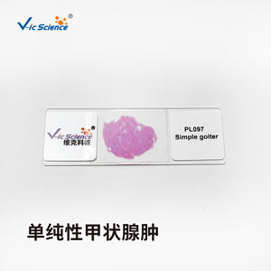 Lames de Pathologie Médicale Humaine 50 pièces, Lames de Pathologie Vétérinaire, <span class=keywords><strong>Papillome</strong></span> Cutané, Lames de Pathologie Médicale - Product Image 5