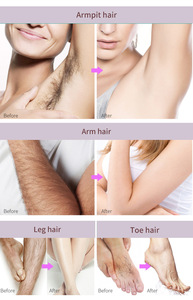 Commercio all'ingrosso permanente dourless spray per la crescita dei capelli spray inibitore della crescita dei capelli siero per gli uomini capelli rimuovere i capelli - Product Image 4