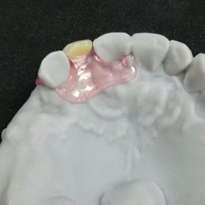 Productos dentales removibles parciales sin metales, dentaduras temporales, dientes acrílicos flexibles, <span class=keywords><strong>Valplast</strong></span>, el precio más bajo para agente dental - Product Image 4