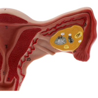 Modèle médical d'organe reproducteur féminin Anatomie humaine Modèle d'utérus féminin